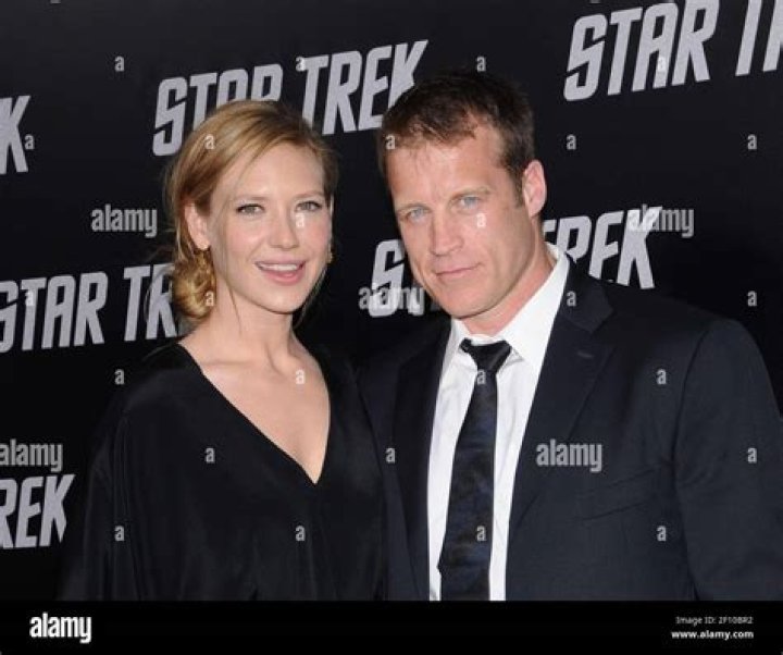 Anna Torv Bio, Wiki, Age, Height, Family, Husband, Movies and Net Worth.