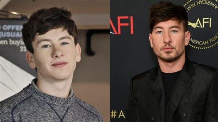 Barry Keoghan May Have Had Plastic Surgery To Fix His Face!