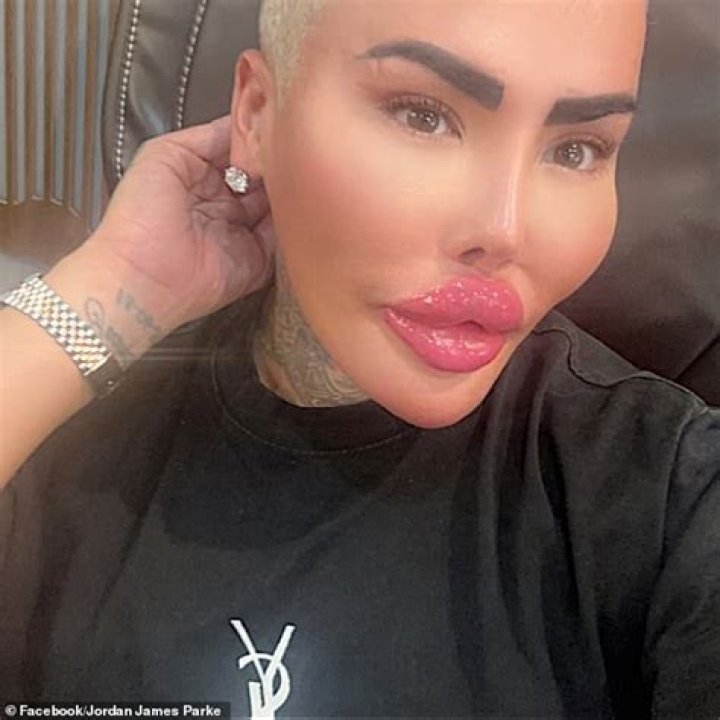 Botched – Who Is Hurricane Garrett Sugar Baby? Age Real Name & Instagram