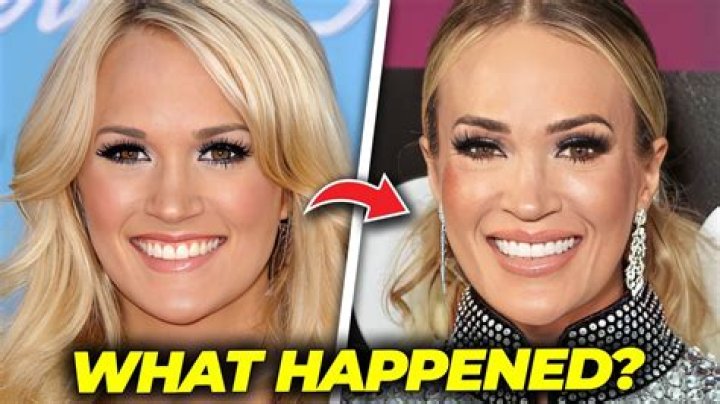 Cheerleader Kallie Ketchersid Accident -What Happened To Her?