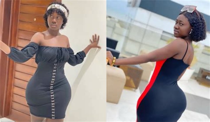 Hajia Bintu Surgery, Before And After