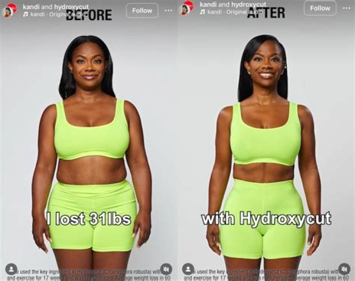 Hannibal Buress Weight Loss, Girlfriend, Net Worth, Wife: Facts on His Height, Age