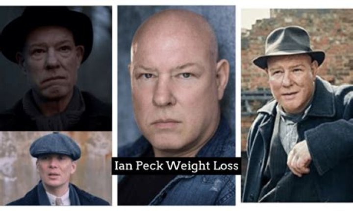 Ian Peck Weight Loss Explained: What Happened To The Actor Who Plays Curly In Peaky Blinders?