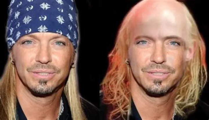 Is Bret Michaels Bald Without Wig, What Happened To His Hair? Before and After Pics