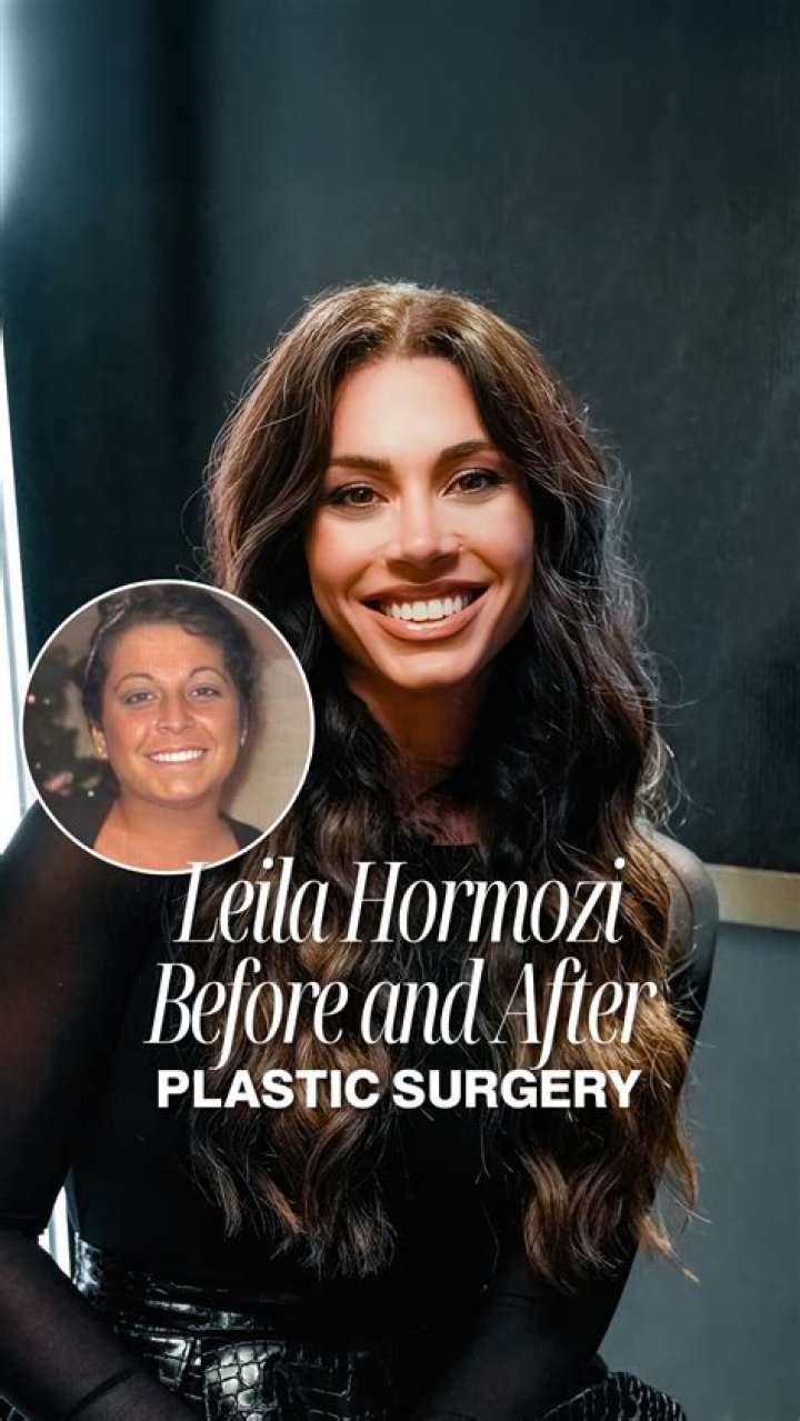Is Leila Hormozi Transgender? Before Surgery Photos – Meet Husband Alex Hormozi