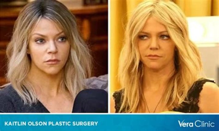 Kaitlin Olson Plastic Surgery As Dee From Always Sunny