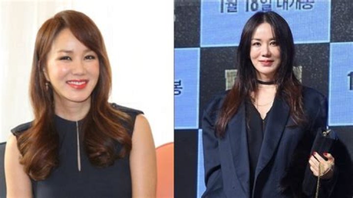 Uhm Jung-hwa’s Plastic Surgery: Did She Get Botox to Look Young?