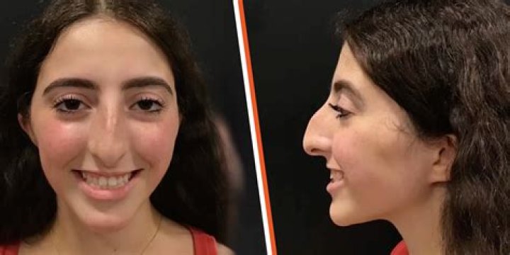 What Happened To MSNBC Anchor Yasmin Vossoughian’s Face? Mouth Surgery Update After Stroke