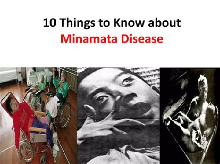 Who Is Akiko Iwase? Everything To Know About The Cast Of Minamata